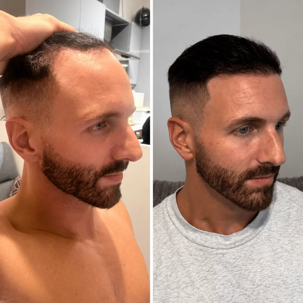 Hårvekstserum roll-on – for tynt hår